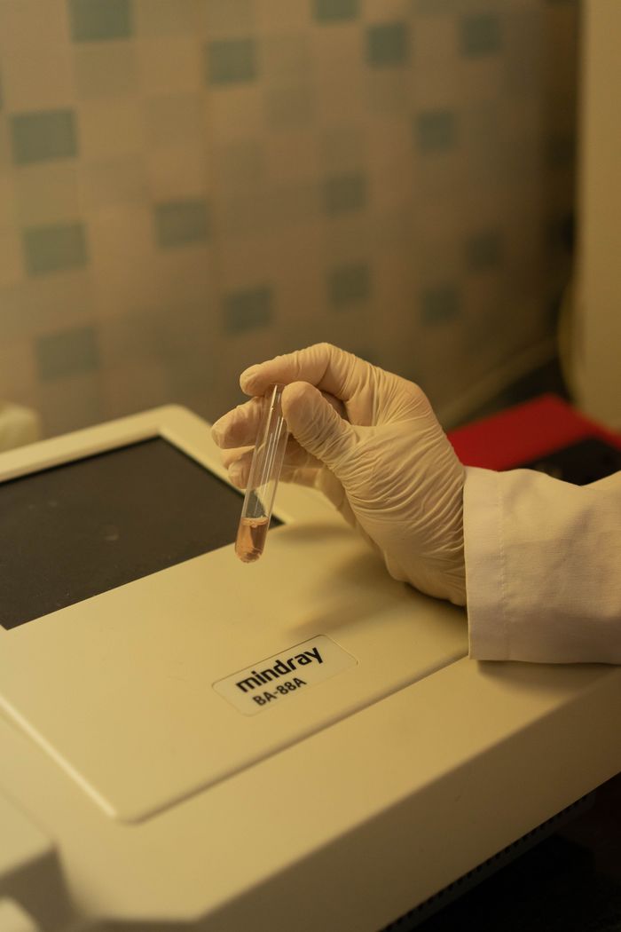 hero-01 Lab technician's gloved hand holding a vial near a semi-automatic chemistry analyzer.