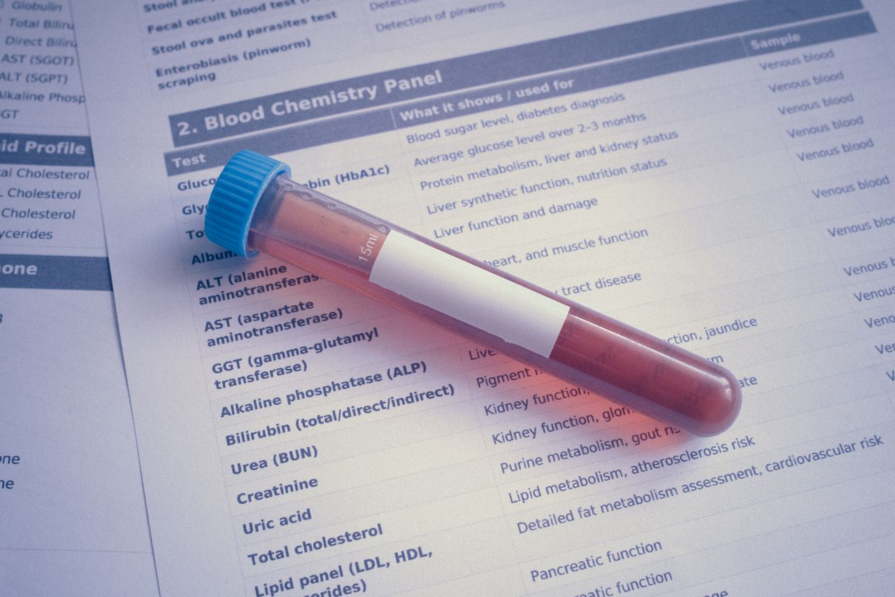 about-02 A blood sample tube placed on a chemistry panel document, showcasing medical testing.
